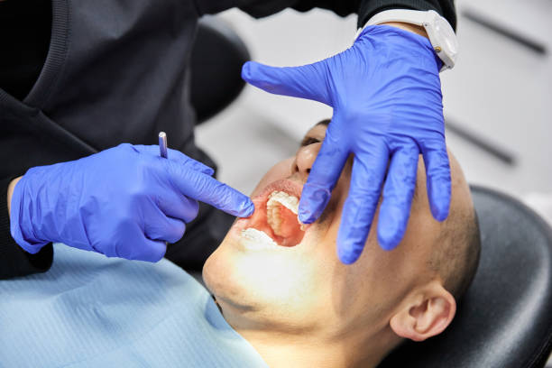 Best Emergency Tooth Extraction in Richmond, UT